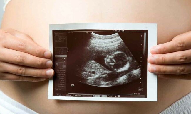 Berührende Einheitlichkeit: Ein Arzt sah die zarten Küsse der Zwillinge auf einem Ultraschallbild