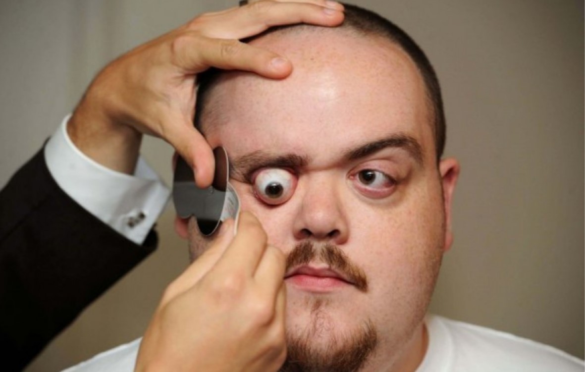 Er sieht alles den Mann mit den am weitesten vorstehenden Augen der Welt. Uberalles Er sieht alles den Mann mit den am weitesten vorstehenden Augen der Welt. Uberalles