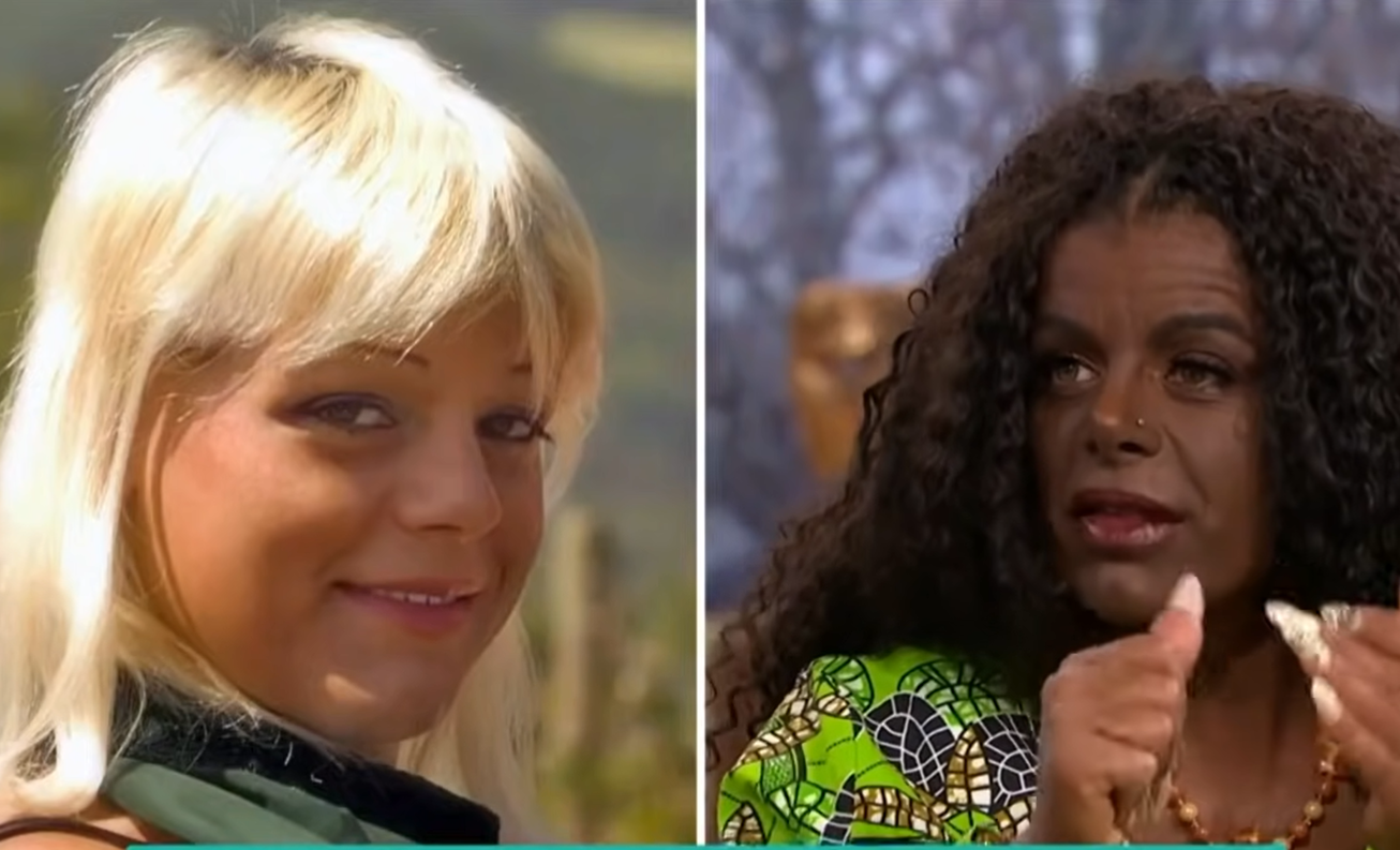 Martina Big eine junge Frau, die ihr Aussehen zu stark verändert hat